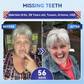 charnent® 🦷 Tideglusib Fast‑Dissolving Tooth & Gum Repair Oral Strips ✨