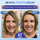 charnent® 🦷 Tideglusib Fast‑Dissolving Tooth & Gum Repair Oral Strips ✨