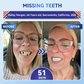 charnent® 🦷 Tideglusib Fast‑Dissolving Tooth & Gum Repair Oral Strips ✨