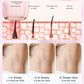 🔥9 levels of hair removal 🧊laser and IPL, pain-free. (Reimbursable in the event of disability)