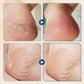 🌿LAST DAY SALE: ONLY ￡9.99!!🎁✨Hydrating and Anti-Cracking Foot Cream