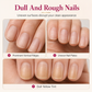 💰💅 Nail Ridge Filler on Sale: Smooth Nails at the Best Price ✨
