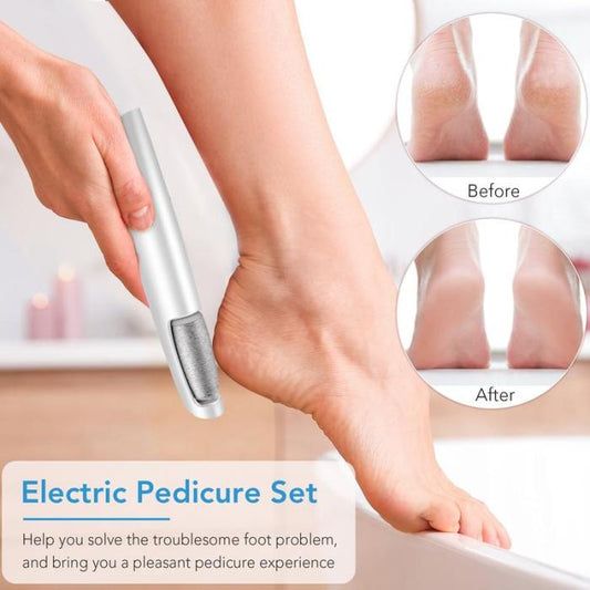 🔥Last Day Special Price £9.99!!💥-🎁Portable Electric Feet Callus Remover
